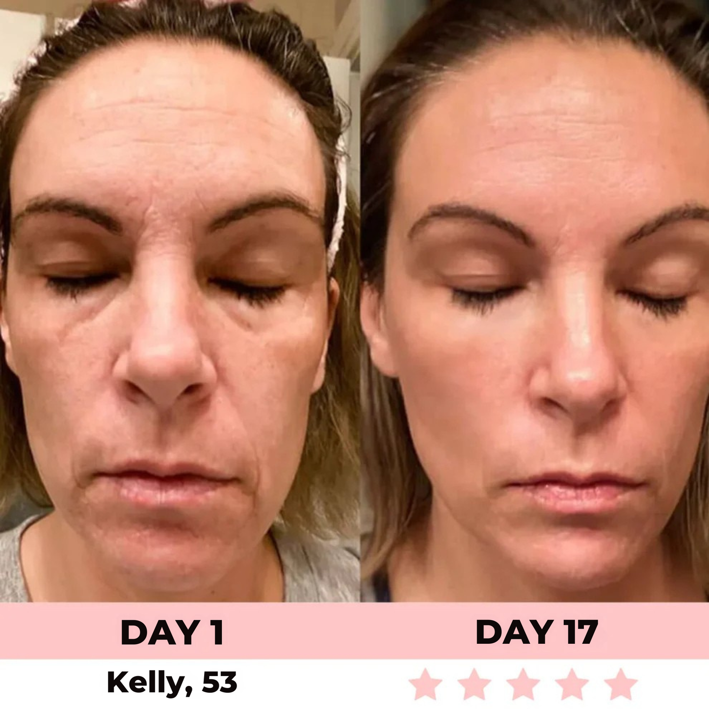 7-in-1 LED Facial Sculptor