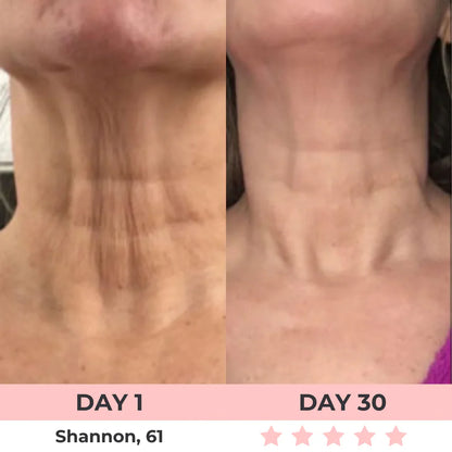7-in-1 LED Facial Sculptor