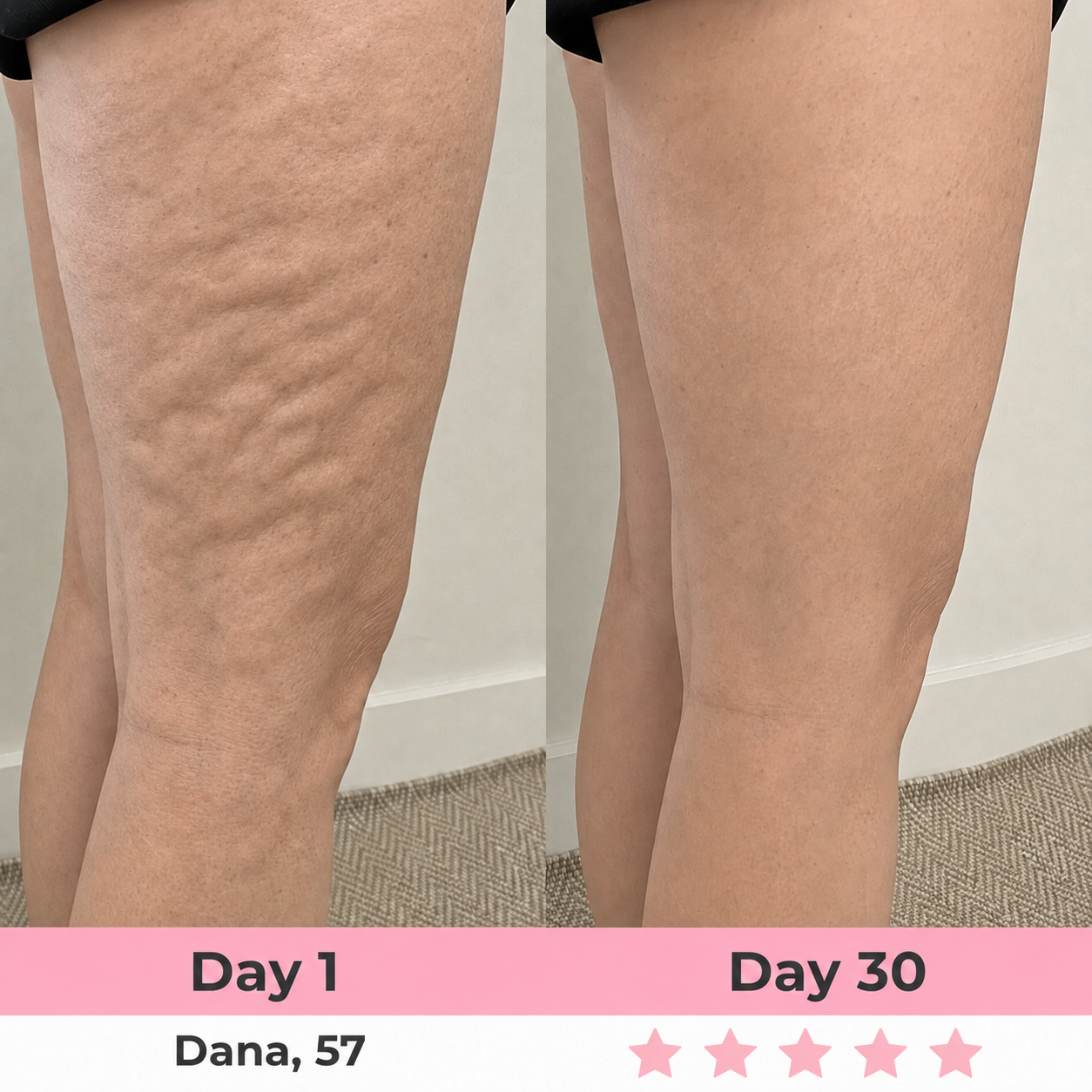 Seluna Anti-Cellulite Massage Oil