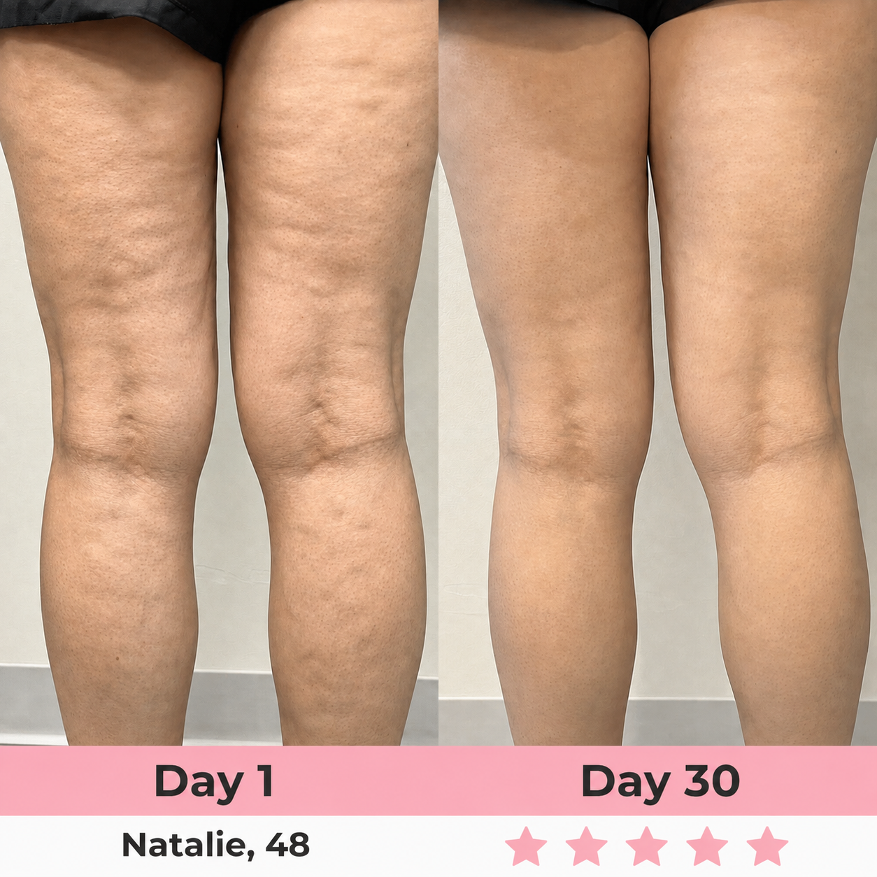 Seluna Anti-Cellulite Massage Oil