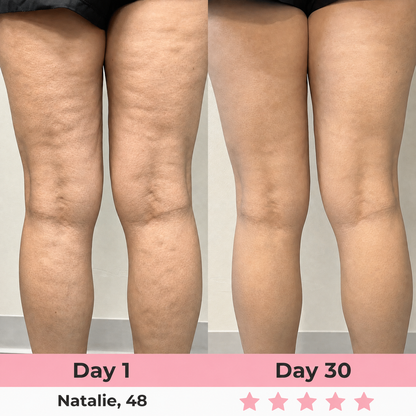 Seluna Anti-Cellulite Massage Oil